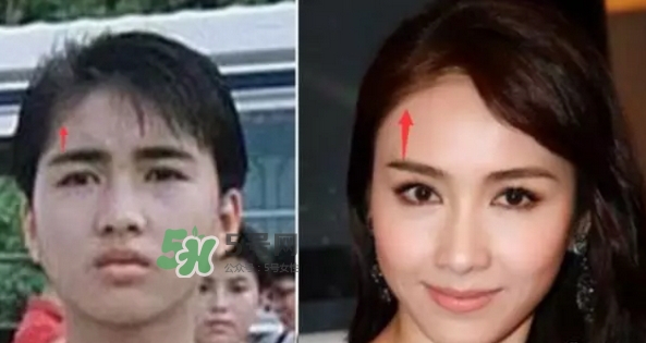 发际线低怎么调整？标准的发际线图片